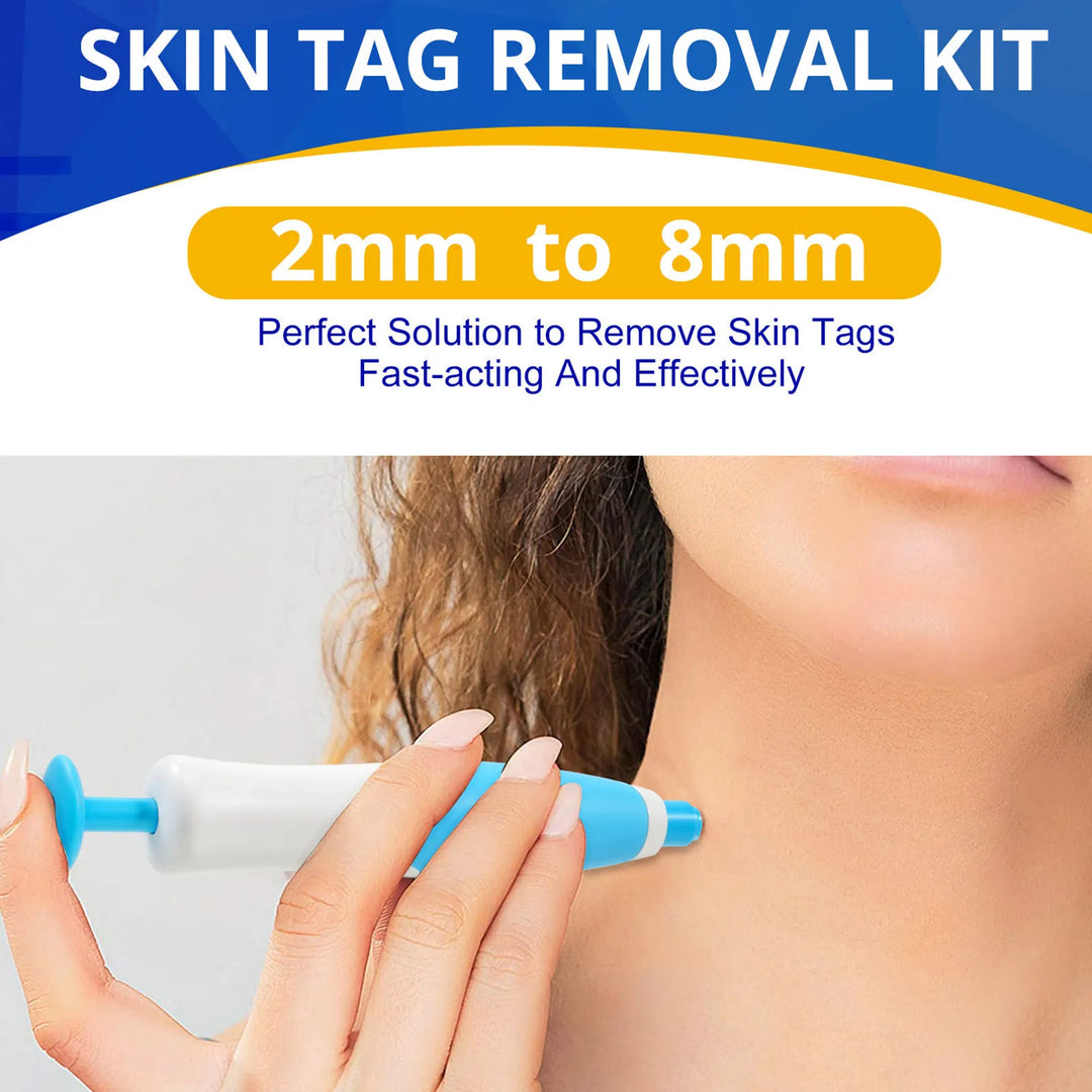 Painless Skin Tag Removal Kit