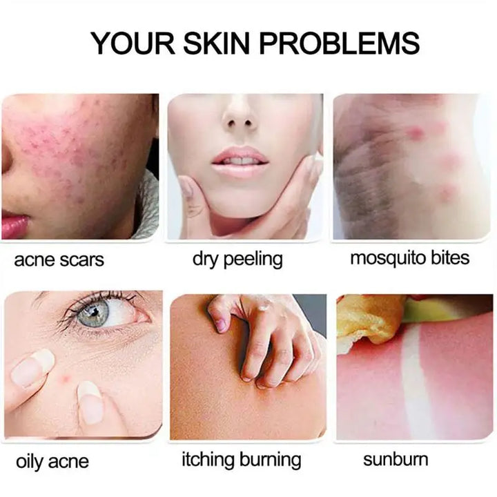 99% Aloe Vera Gel Moisturing Skin Face Cream Shrink Pores Day Cream Skincare Sleeping Mask Korean Skin Care Products