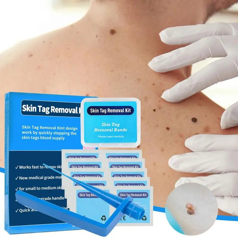 Medical Grade Skin Tag Removal Kit