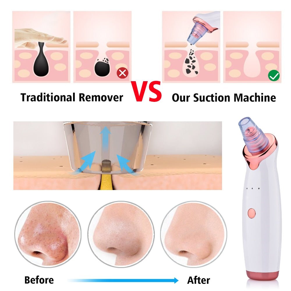 Blackhead Remover Skin Care Pore Vacuum Acne Pimple Removal Vacuum Suction Tool Facial Diamond Dermabrasion Skin Care Machine-2
